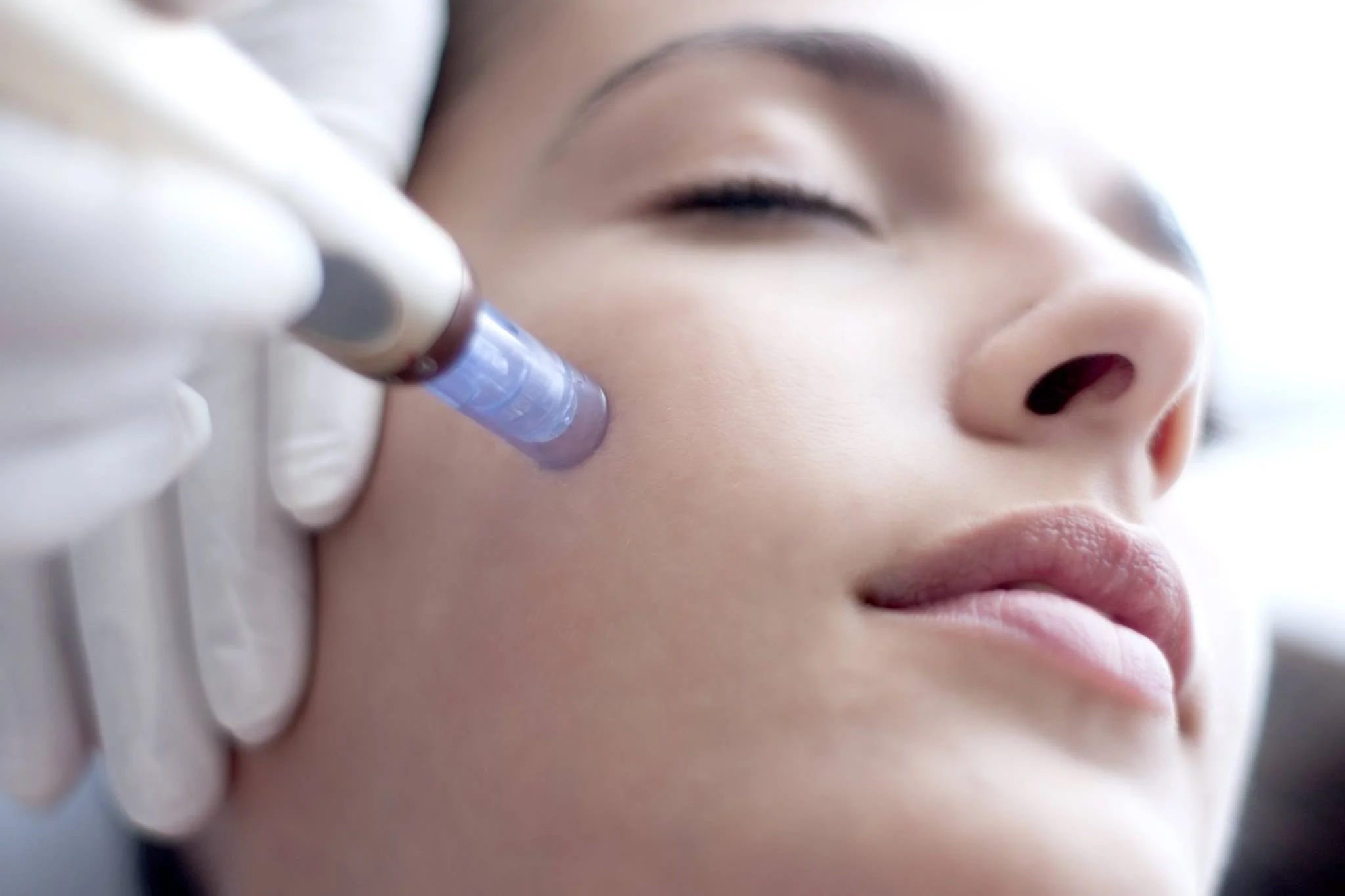 Forget Botox! This Beauty Treatment is Taking Over