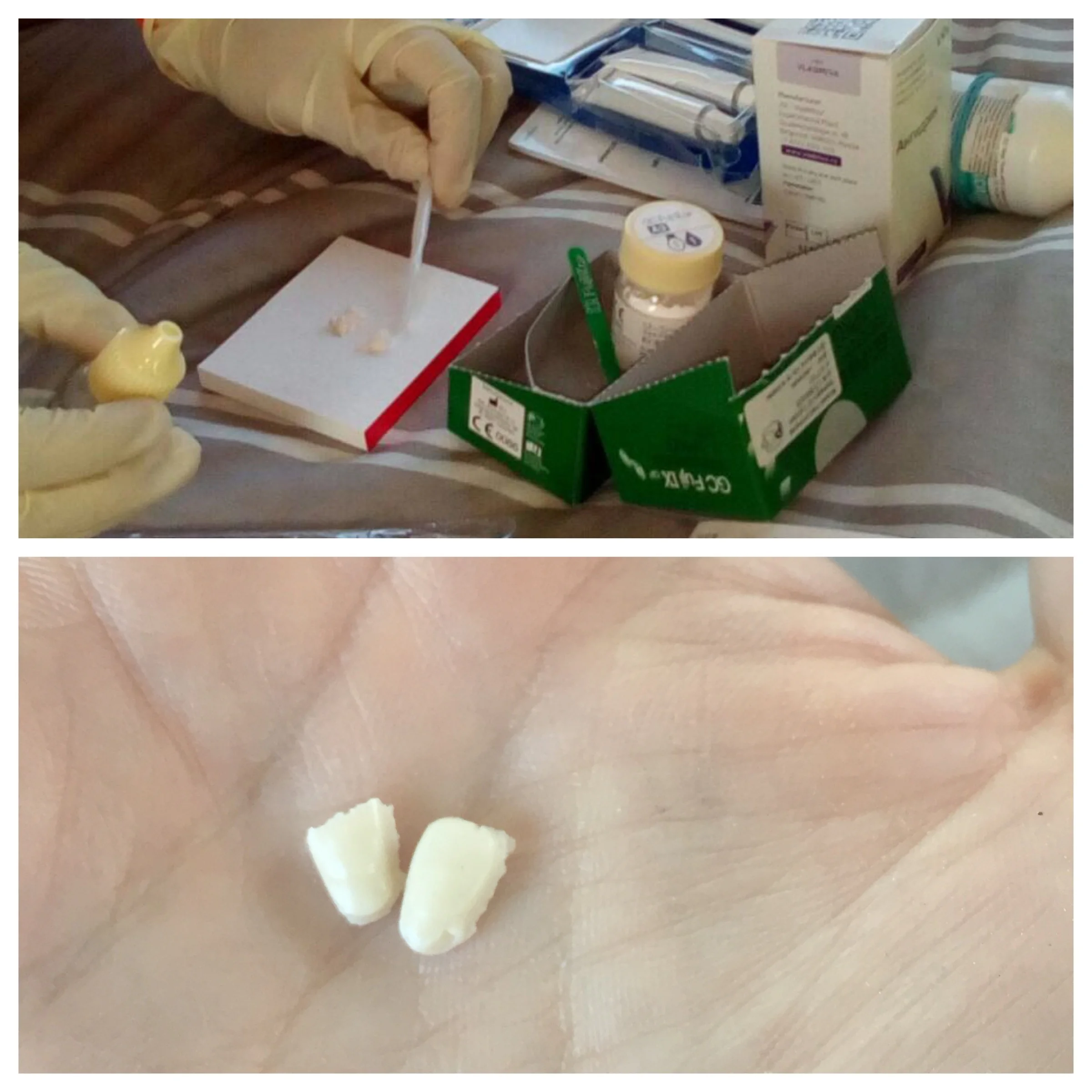 A couple of spare teeth :)!
