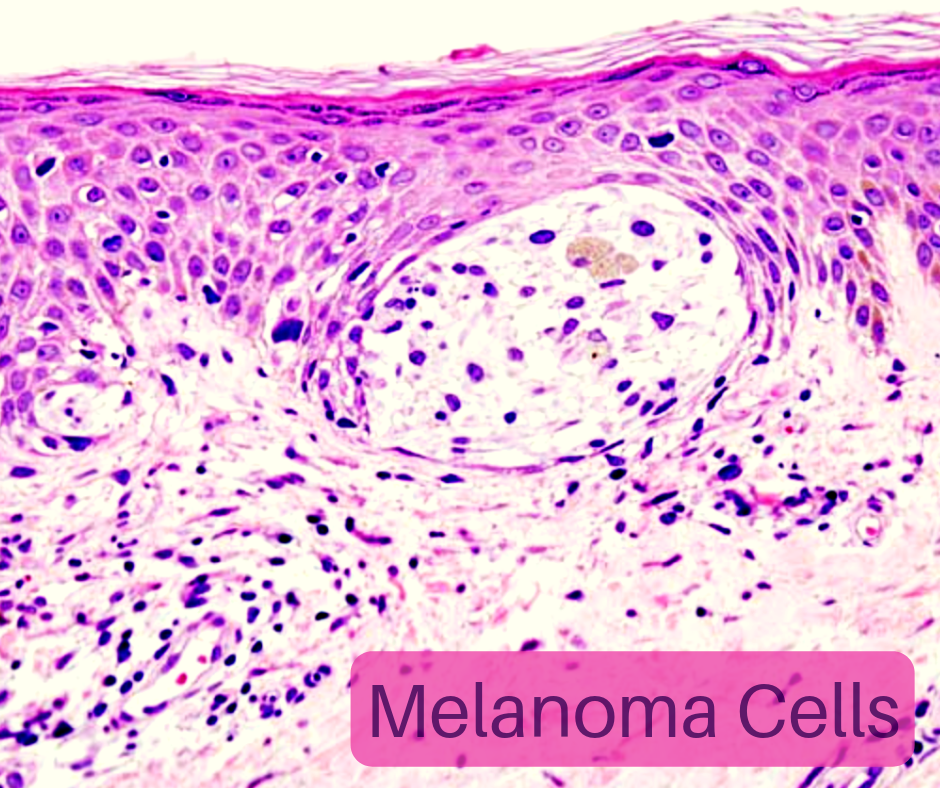 #CancerPhotos