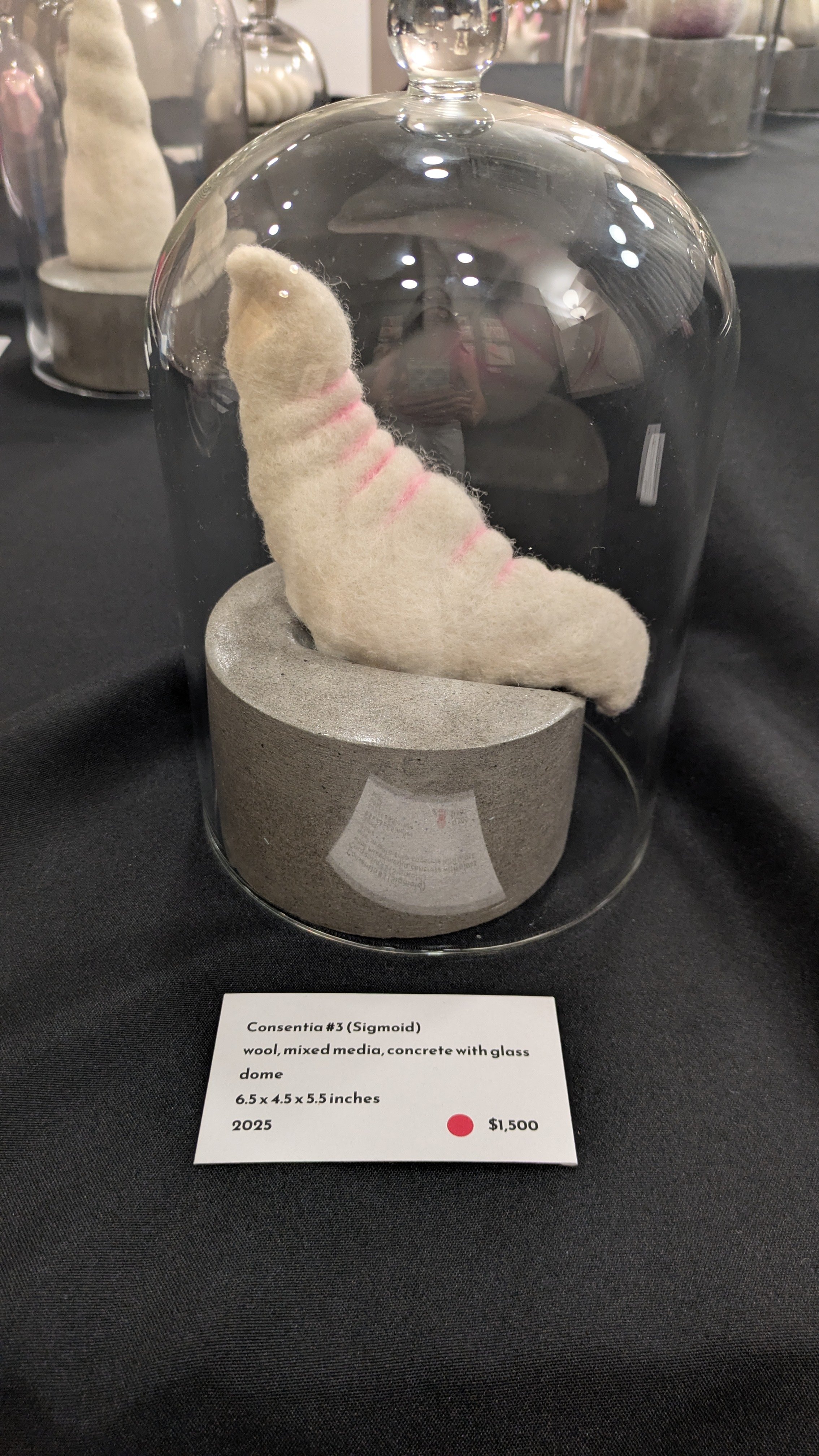 Consentia Sigmoid.jpg