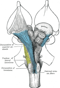 Reticular Activating System in Brainstem
