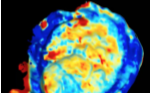 Intraoperative optical scan