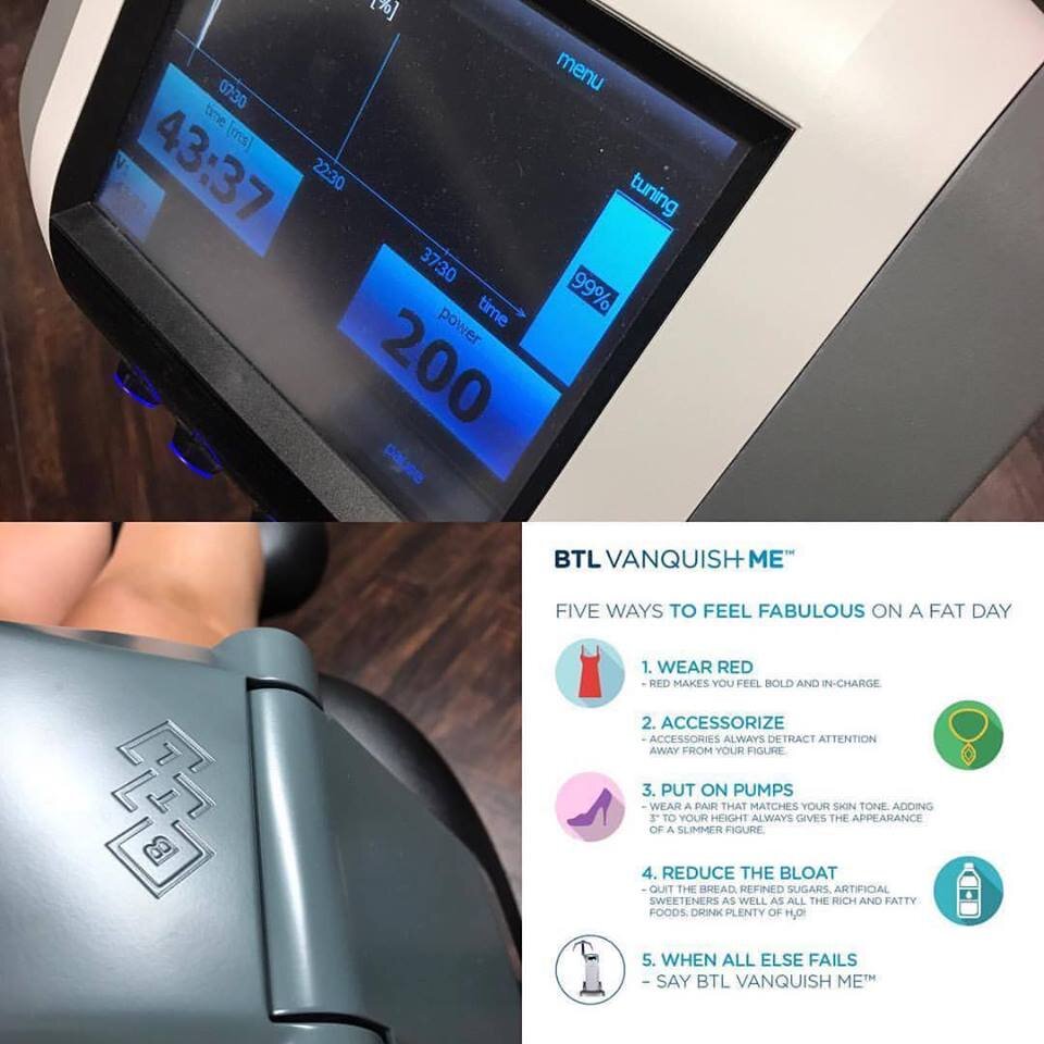 Vanquish ME Fat Reduction and Skin Tightening (large areas)