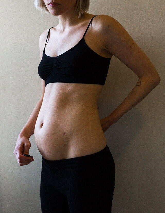 SELFPORTRAIT_THISISENDOMETRIOSIS_GEORGIEWILEMAN.jpg