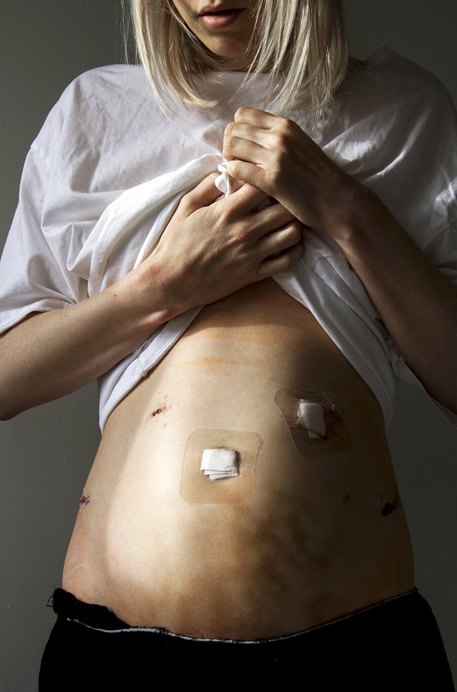SELFPORTRAIT11_THISISENDOMETRIOSIS_GEORGIEWILEMAN.jpg