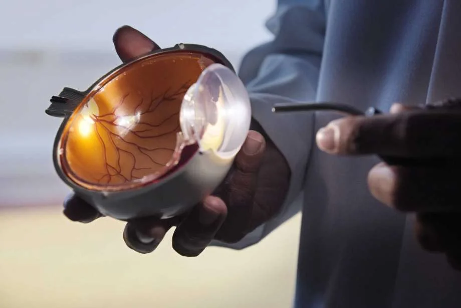 Light entering the eye is condensed to a highly energetic pinpoint on the retina (orange tissue).