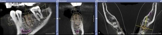 dental+implant+planning+honolulu.jpg
