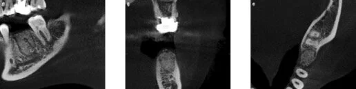 Honolulu Dental implant planning.jpg