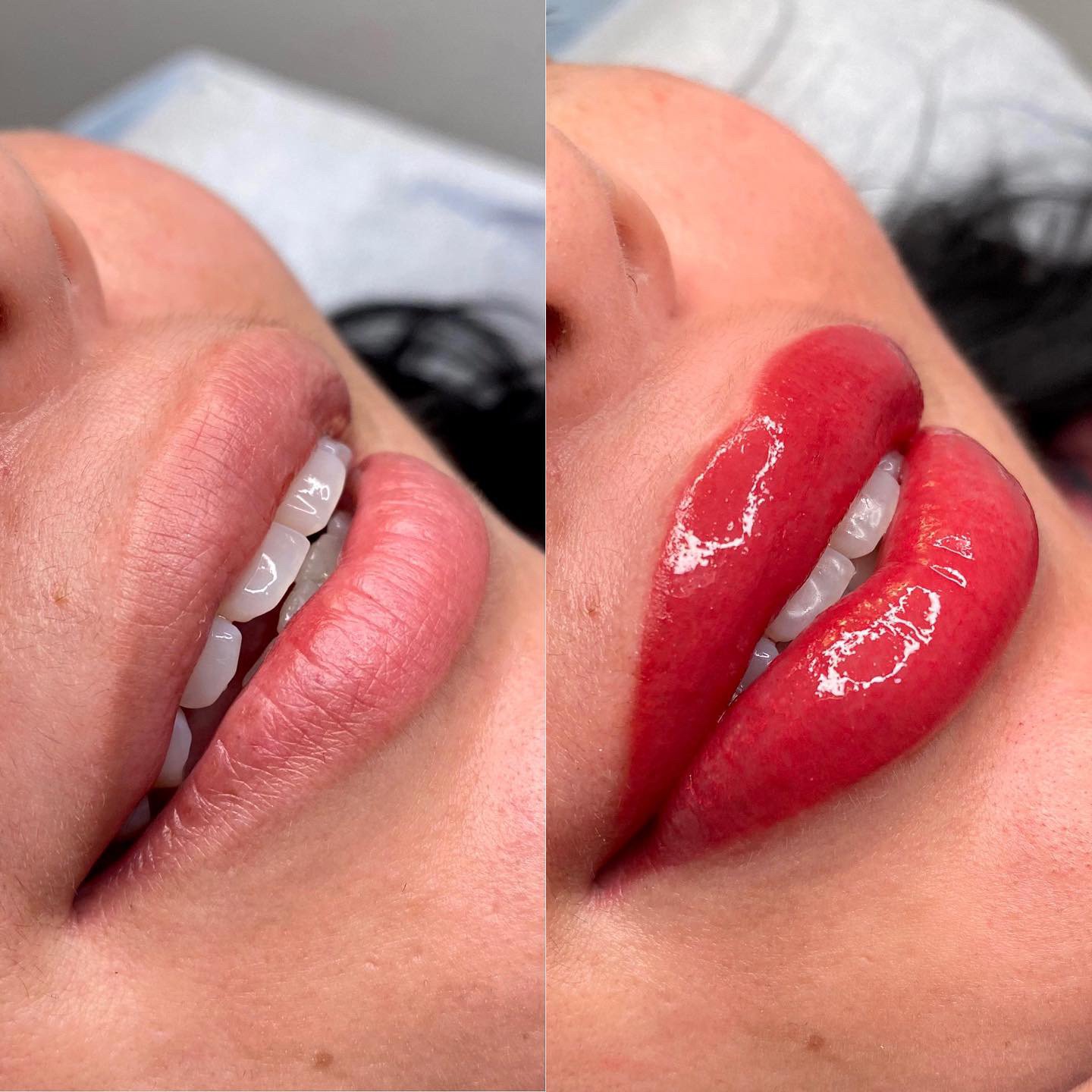 Lip Neutralization - Beauté Boulevard