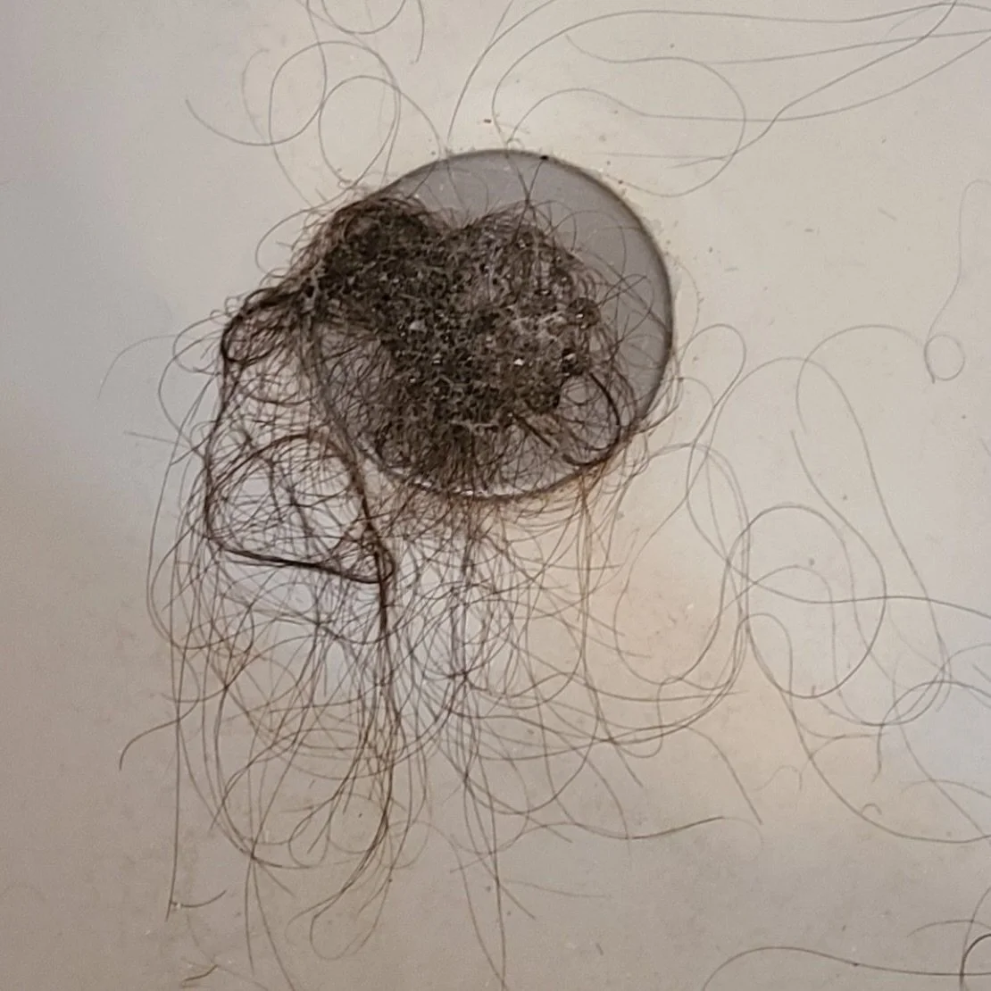 Struggling with hair loss? You&rsquo;re not alone&mdash;and the good news is, there are effective, non-surgical solutions to help restore confidence and support healthy hair growth ✨
.
.
.
.
At Baldwin Beauty we offer advanced treatments designed to 
