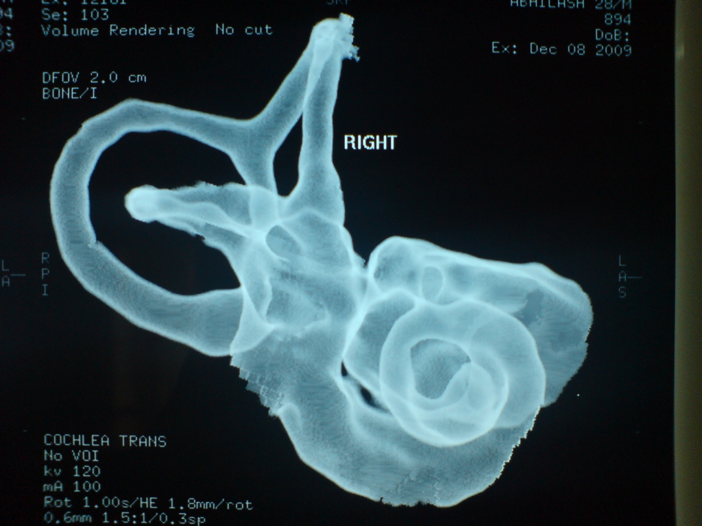 inner-ear01.jpg