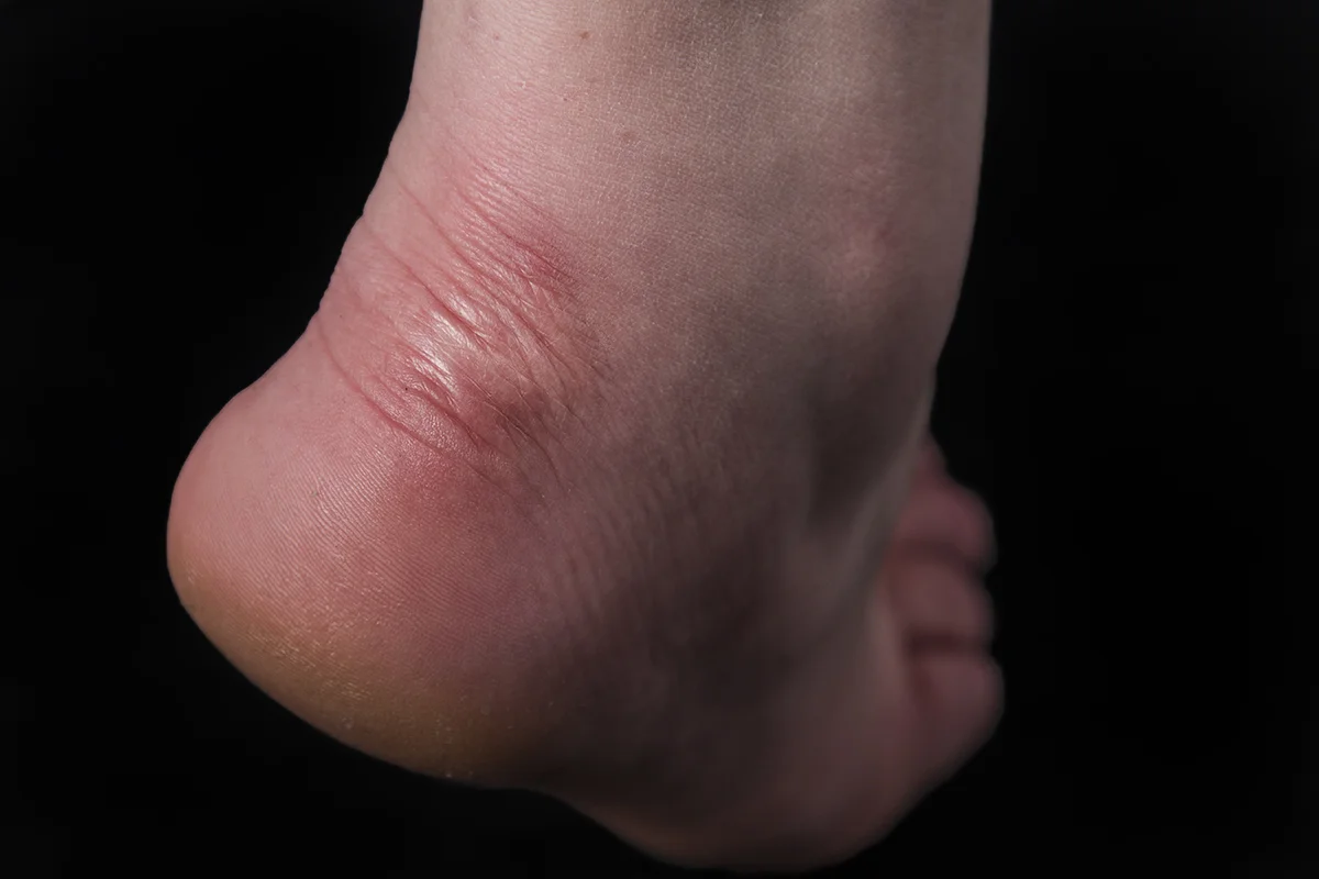 i_wore_sandals_on_a_bicycle.jpg