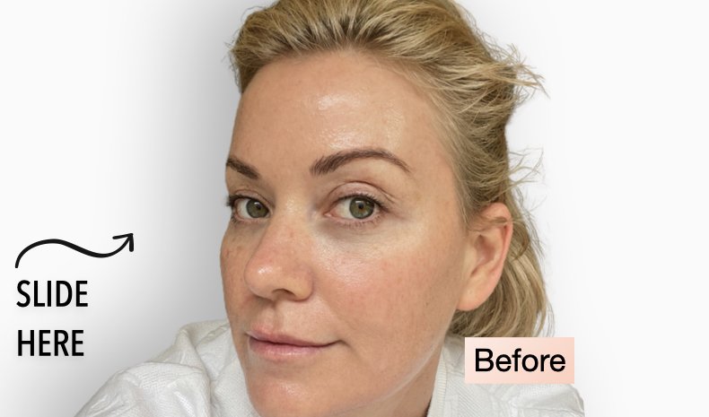 cbm before and after slides.001.jpeg