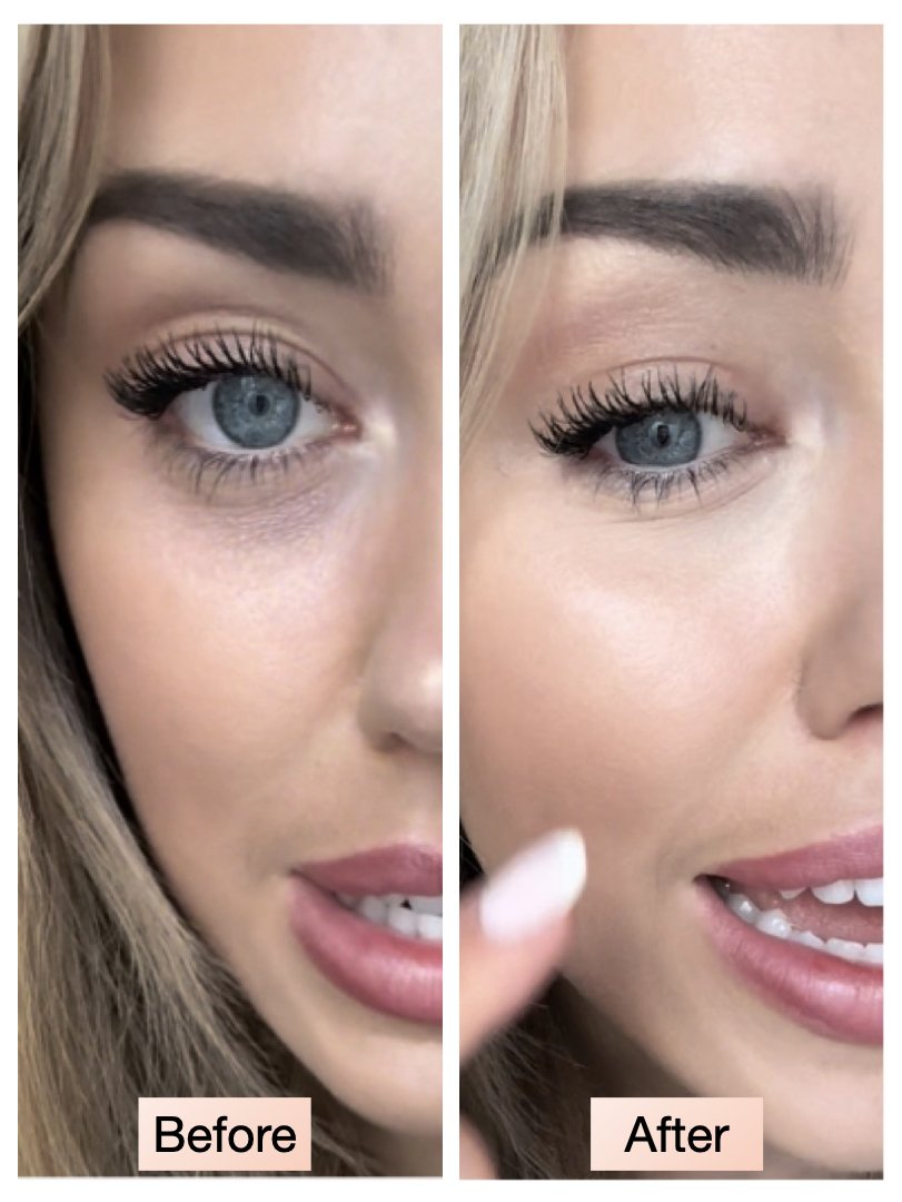 cbm. peach eye concealer dual action, dark circle correction before and after