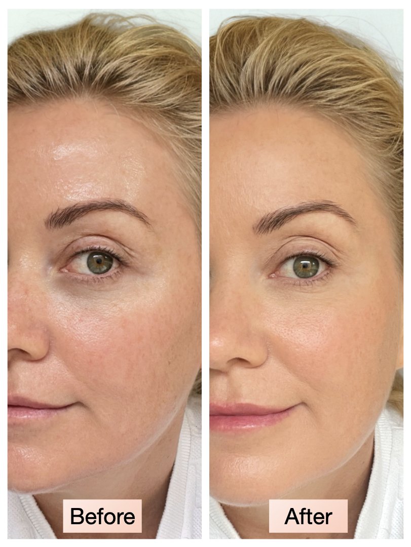 Peach concealer_web images.008.jpeg