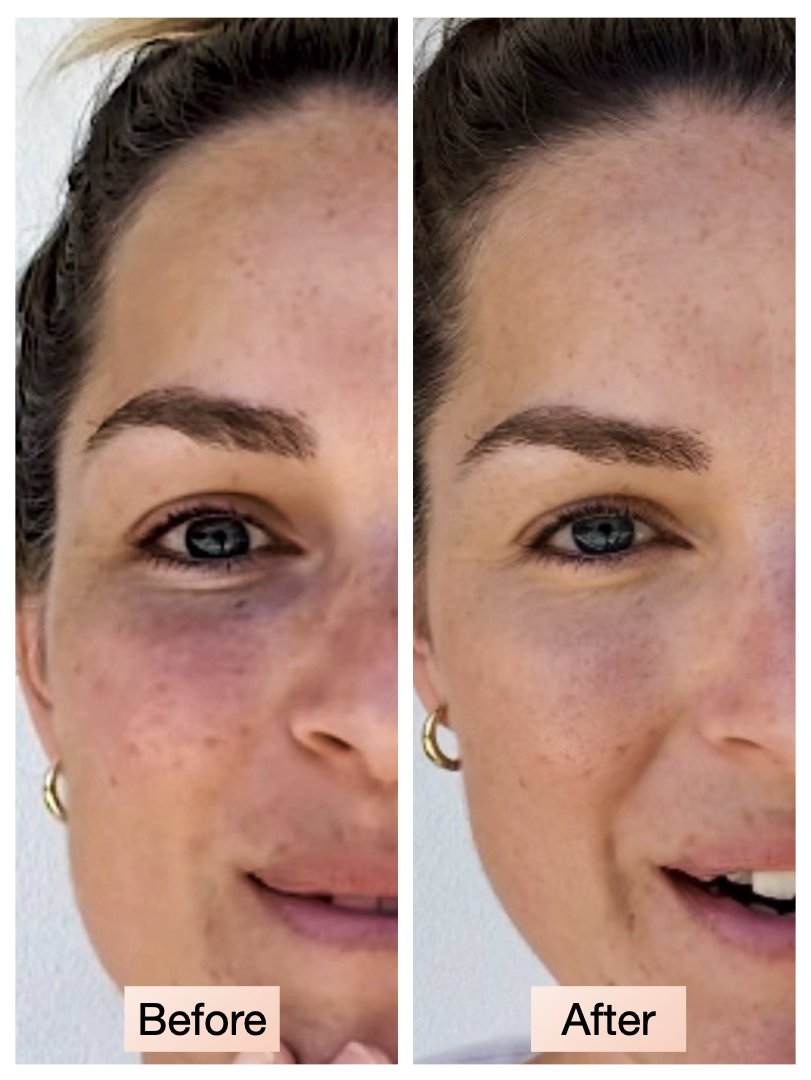 cbm. peach eye concealer dual action, dark circle correction before and after