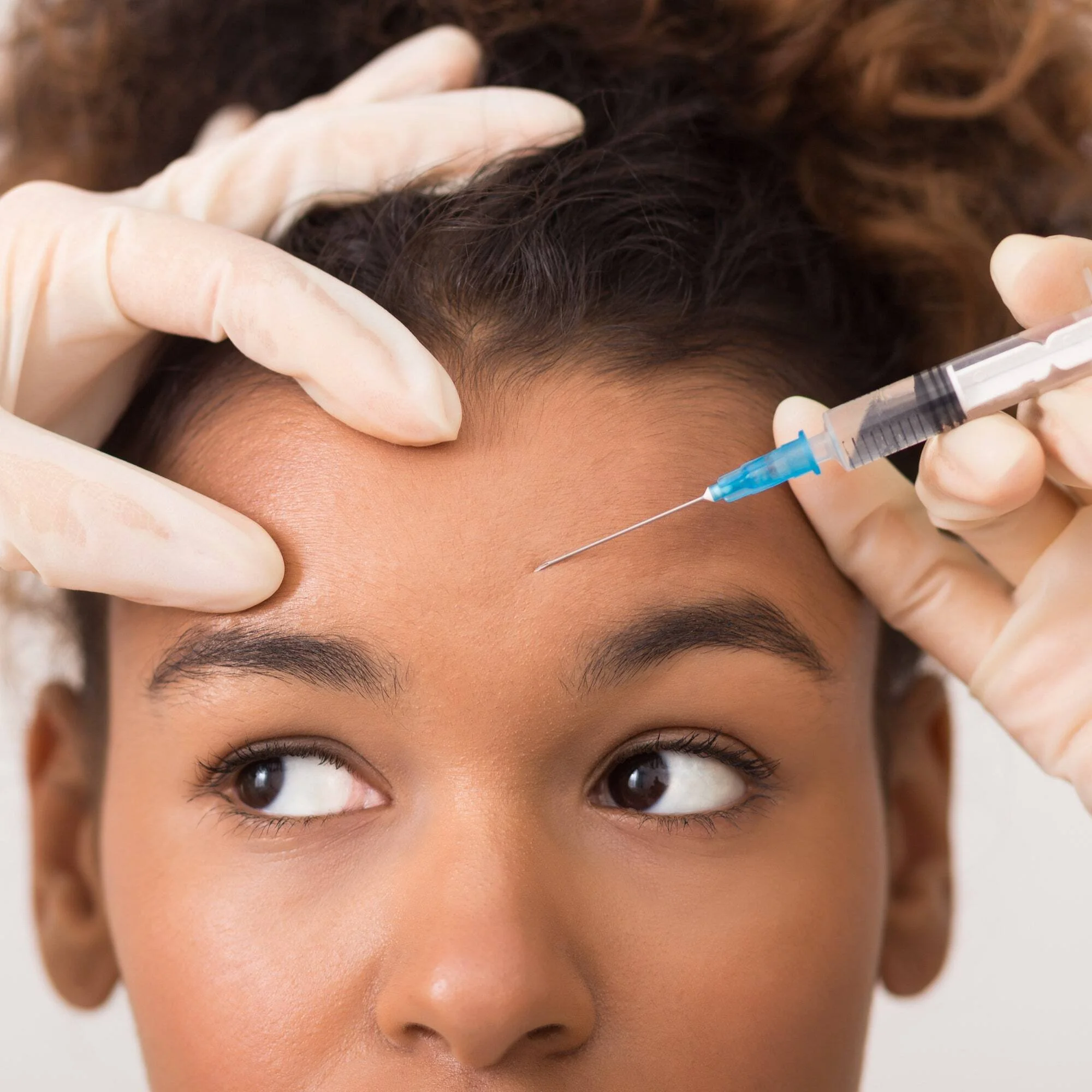 botox in forehead.jpg