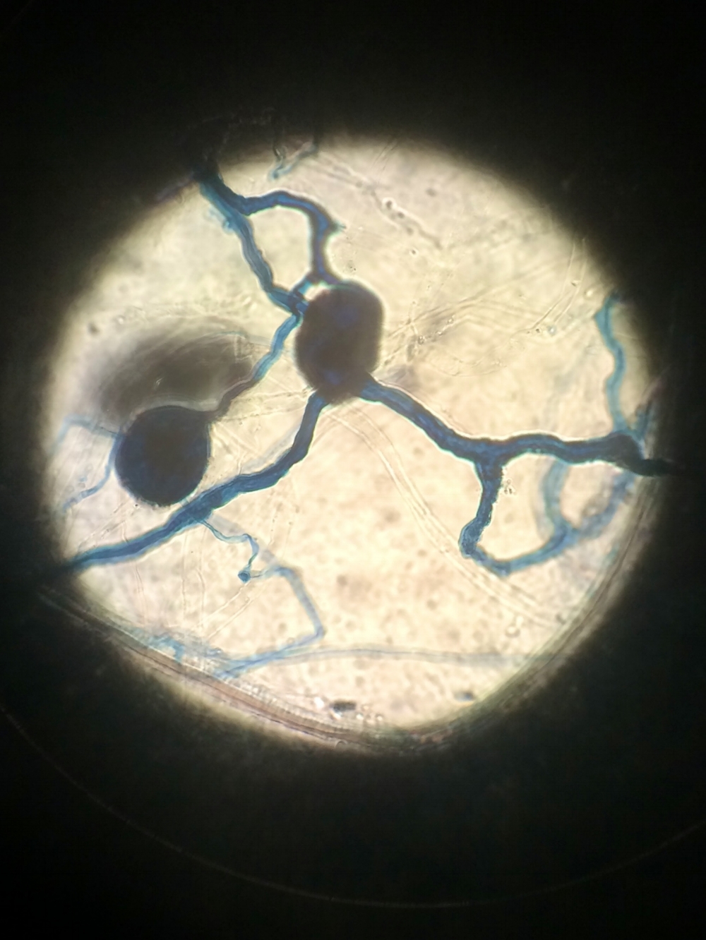 Many native Californian plant species associate with mutualistic arbuscular mycorrhizal fungi, pictured here through the microscope.