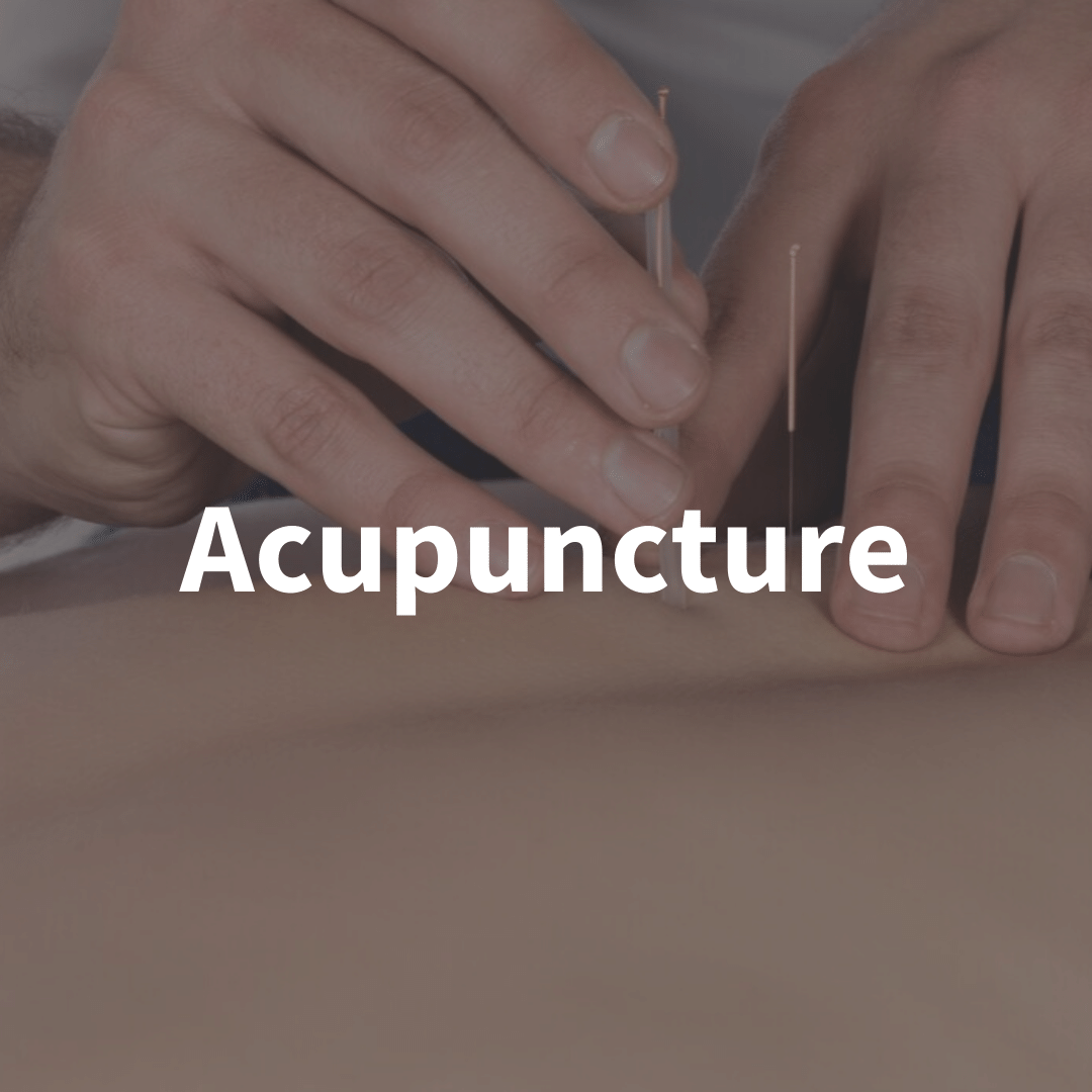 Dry Needling and Acupuncture