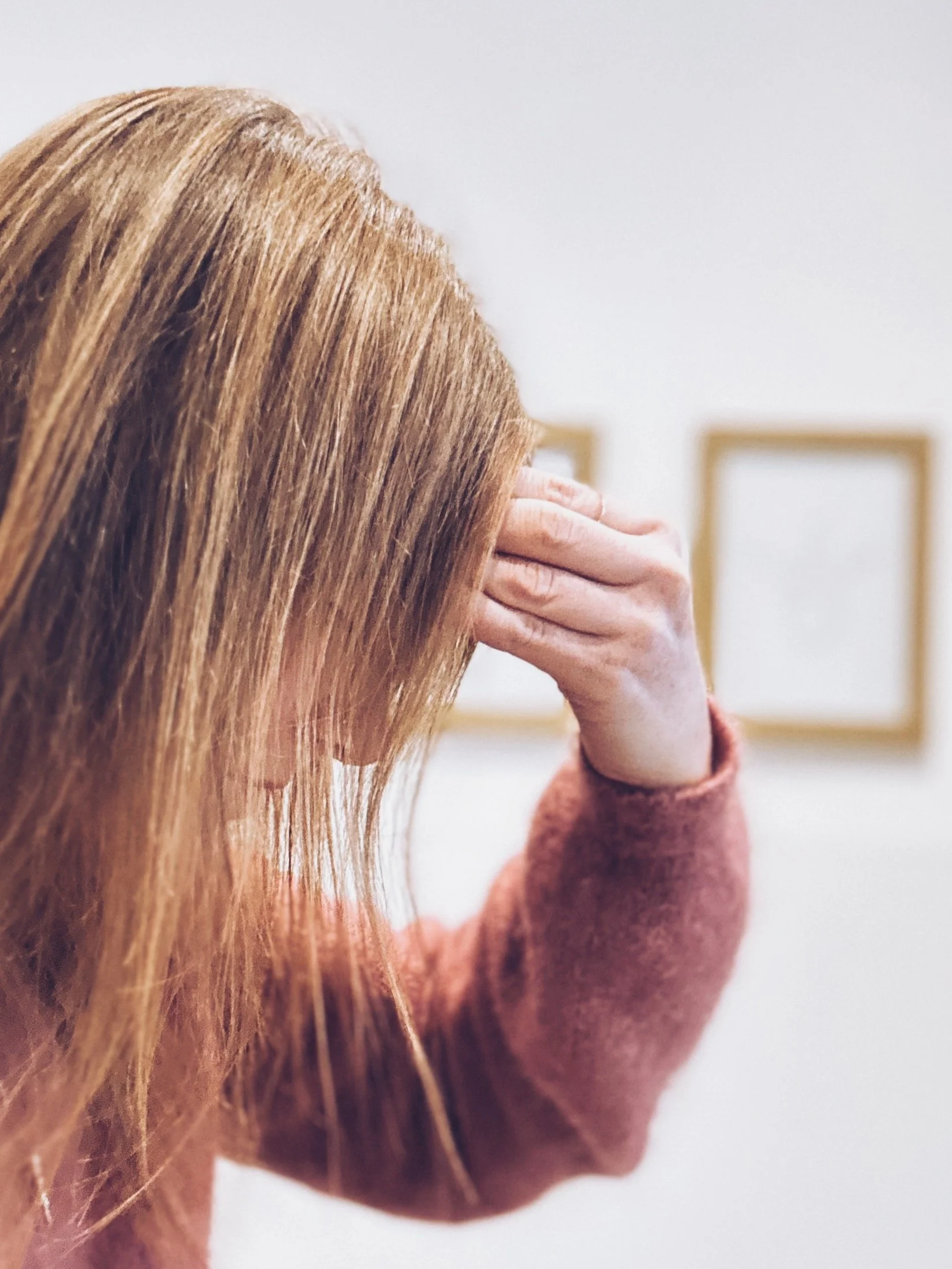 Understanding Tension Headaches and How Dry Needling Can Help