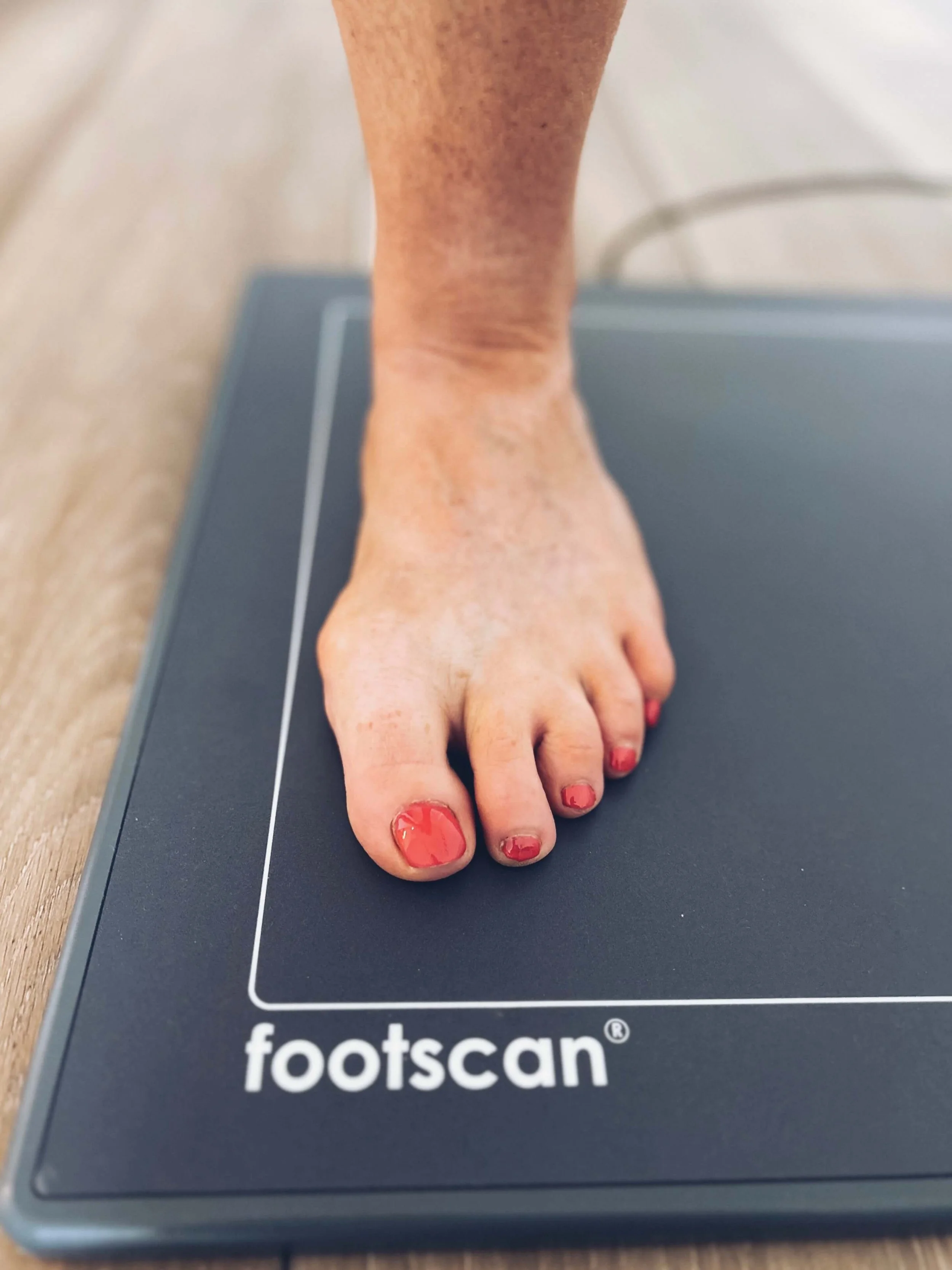 Bunions: How Physiotherapy Can Help