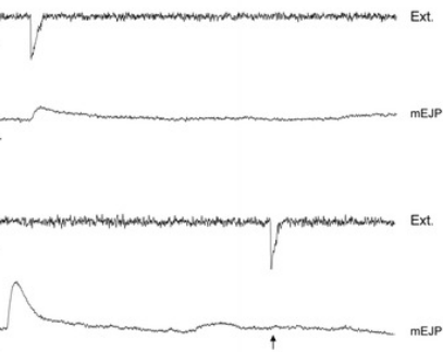 Electrophysiology