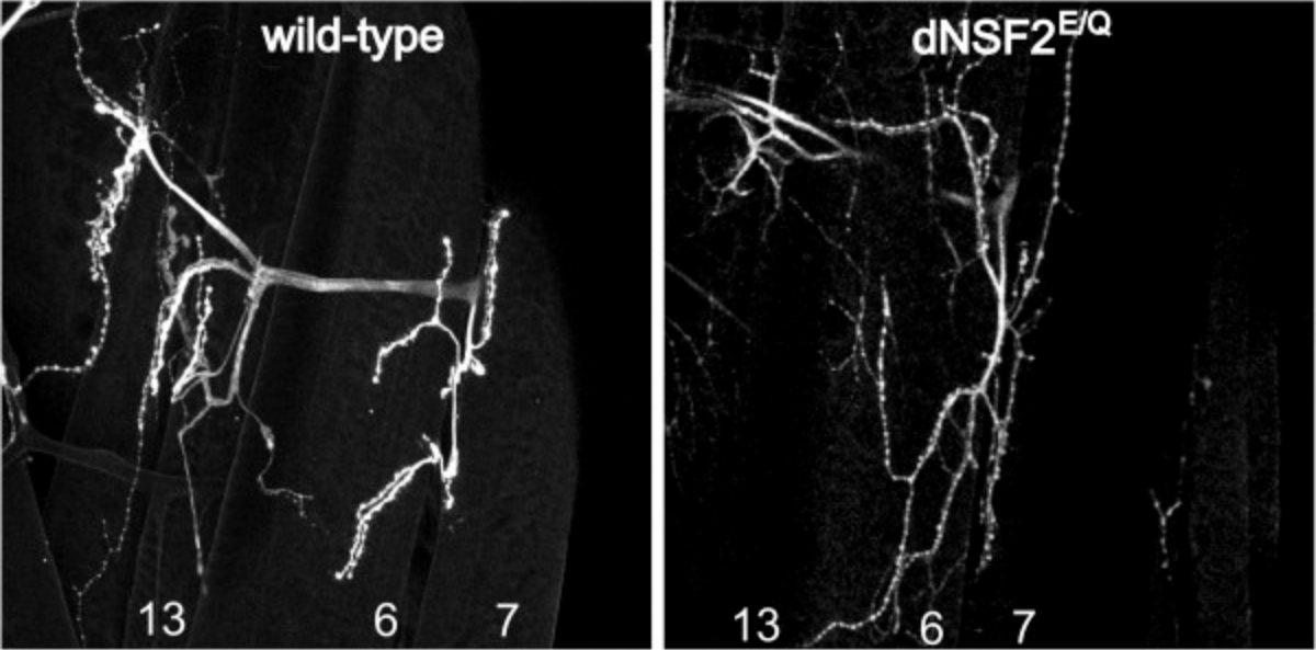 neuromuscular junctions