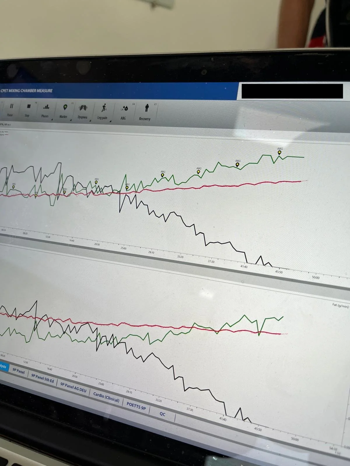 Reasons to Do Metabolic Testing
