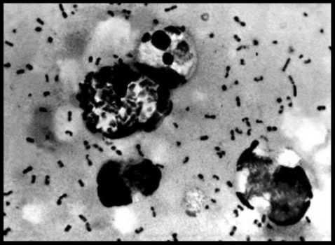 Unit 731 studied anthrax, cholera, and other pathogens by forcibly infecting victims. They experimented with the bubonic plague and tried to weaponize it by using infected fleas and various delivery systems. (Photo: Pixnio )
