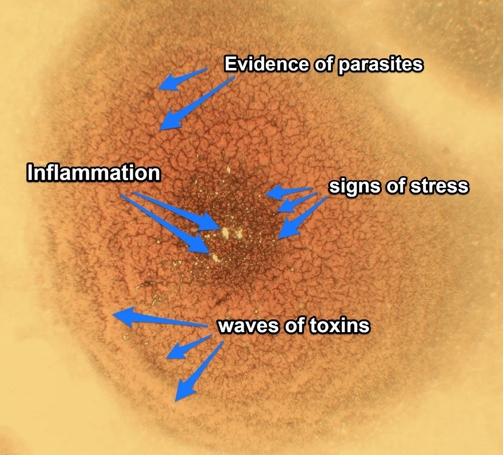pre detox dry 7 stress and inflam annotated small.jpg