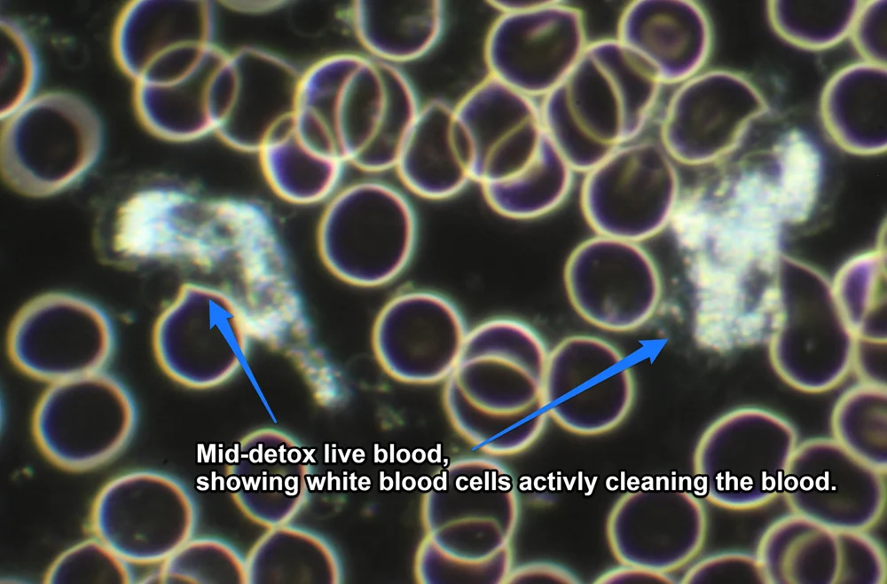 mid detox wbc active annotated small.jpg