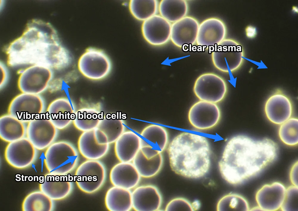 post detox wbc lots and active annotated small.jpg