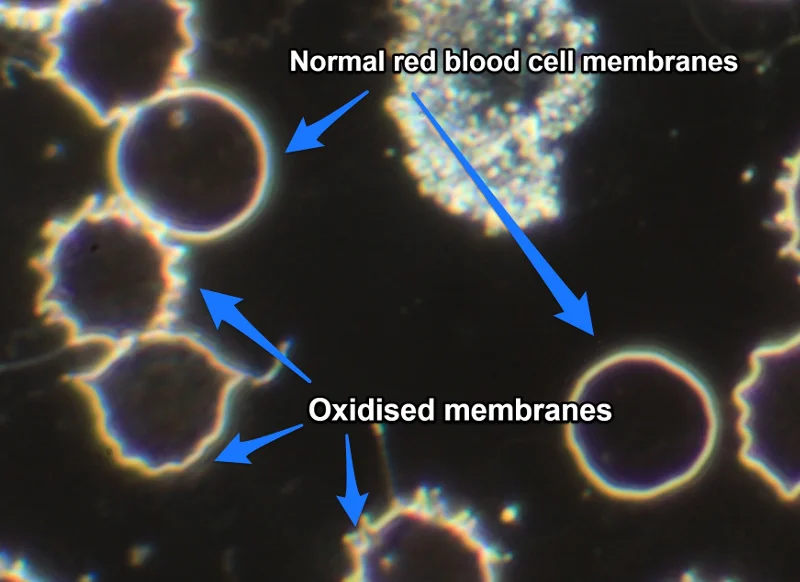 pre detox oxidised membranes annotated sml.jpg