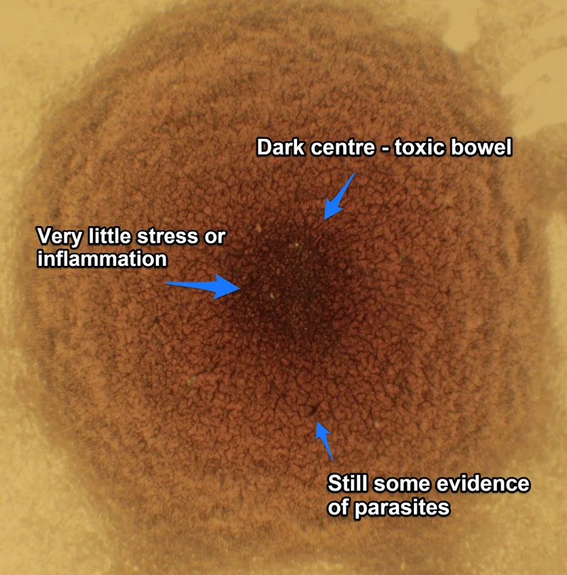 post detox dry 7 toxic bowel annotated small.jpg