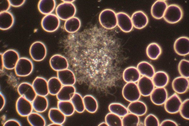 Thrombocyte 2.jpg