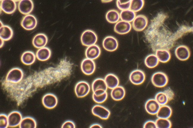 Thrombocyte 3.jpg