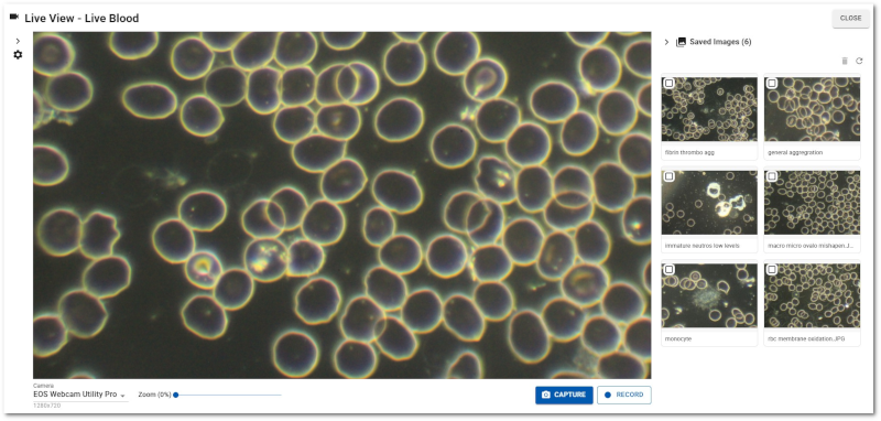 AnalystAssist Live Blood Analysis software
