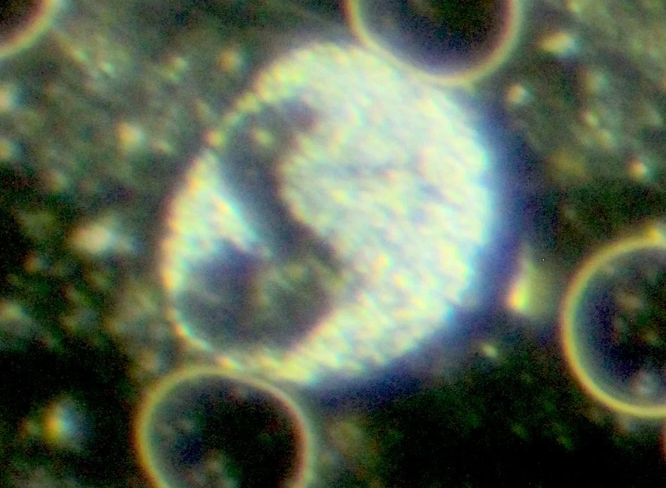 white blood cell under darkfield microscope