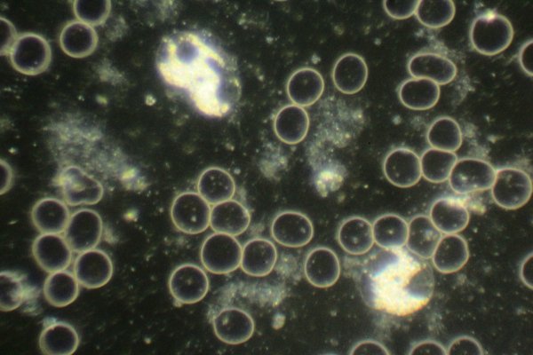 Live Blood slide under 100x darkfield