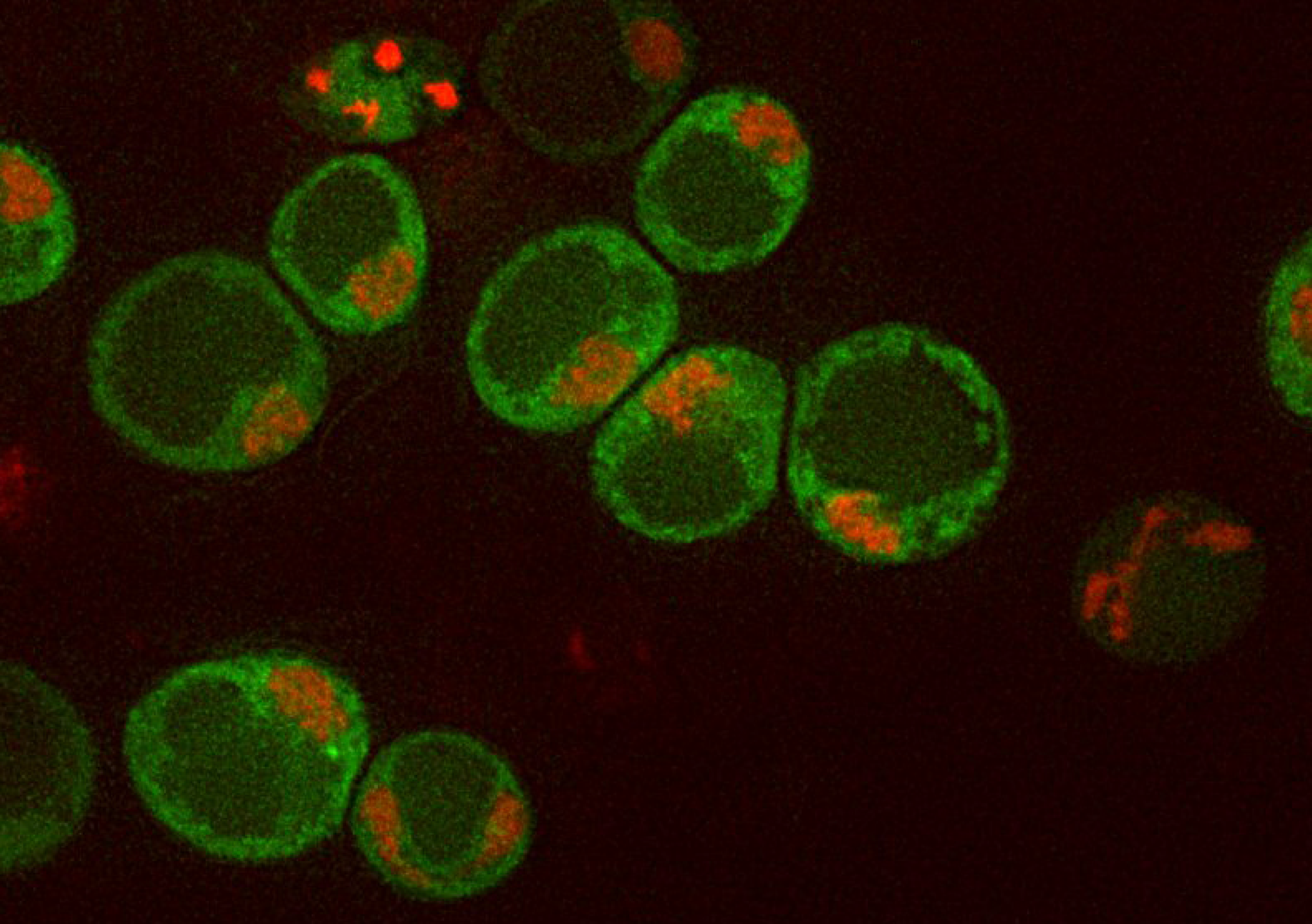 Meiotic yeast cells harboring fluorescently-labeled amyloid-like assemblies (Rim4-EGFP). The nucleus is shown in red (HTB2-mCherry)
