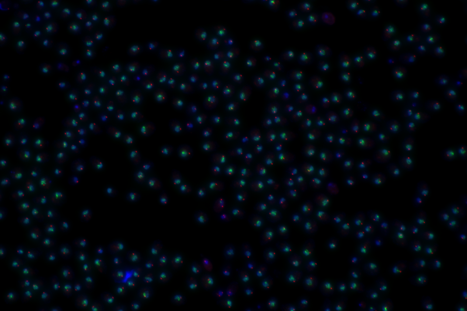 We screen fields of meiotic yeast cells to identify genes that influence formation of amyloid-like assemblies