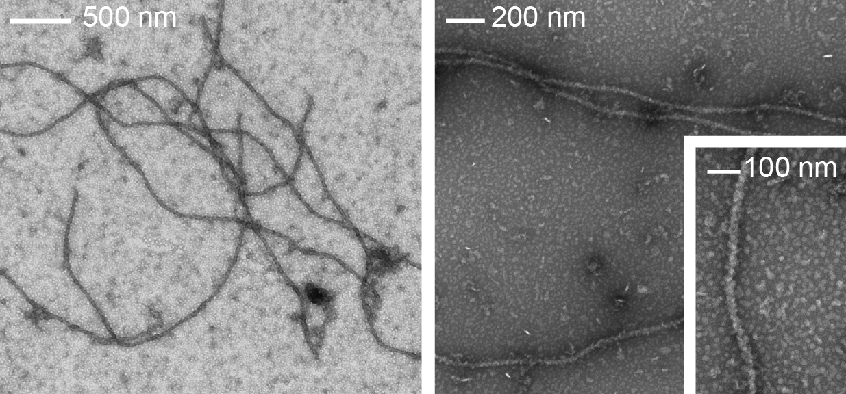 TEM micrographs of Rim4 fibers