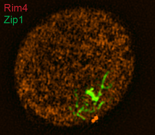 Super-resolution image of fluorescently-labeled amyloid-like assemblies and meiotic chromosomes