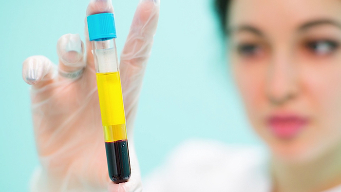 What is SkinPen with PRP?