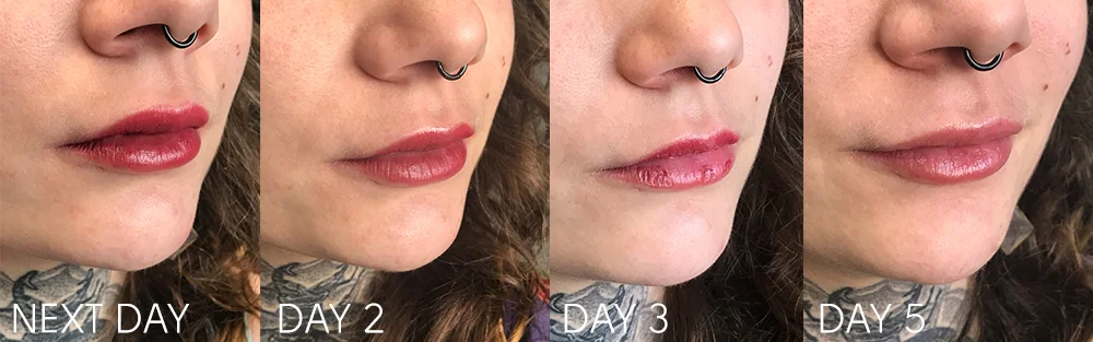 lip-healing.jpg