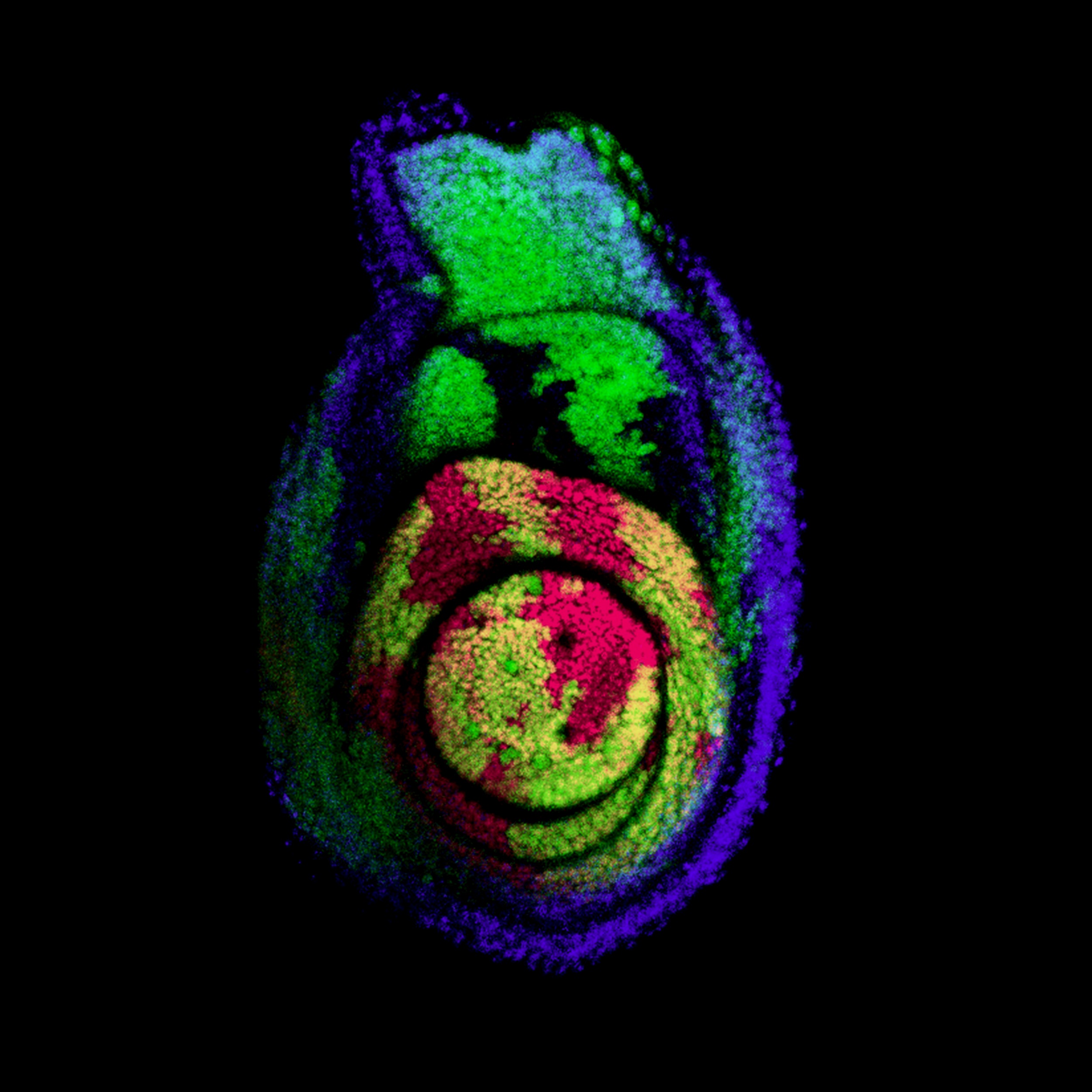 a third-instar Drosophila melanogaster leg imaginal disc containing mitotic clones (Green=GFP, Purple=DAPI, magenta=Distal-less)