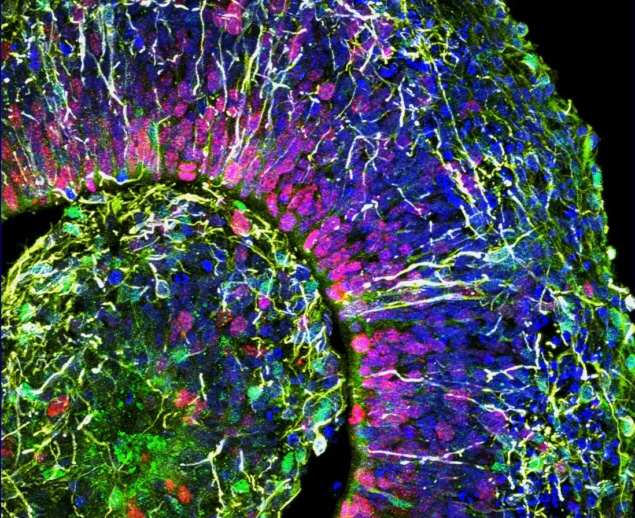 Cross-section of a brain organoid, showing the initial formation of a cortical plate. Each colour marks a different type of brain cell. (Courtesy: Muotri Lab/UCTV)