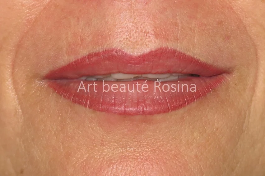 Tout de suite après la pigmentation contour des lèvres corrigé avec dégradé