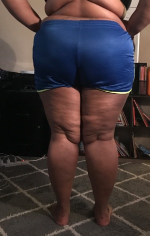 Bbw Cellulite Thighs And Ass