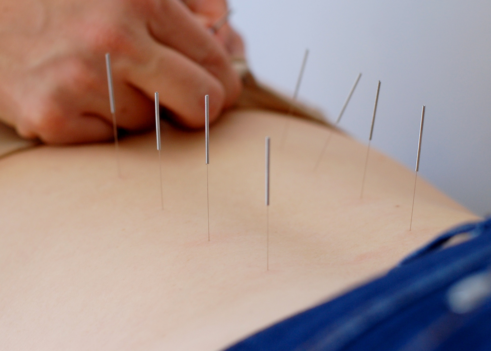 spcacu_needles_web.jpg